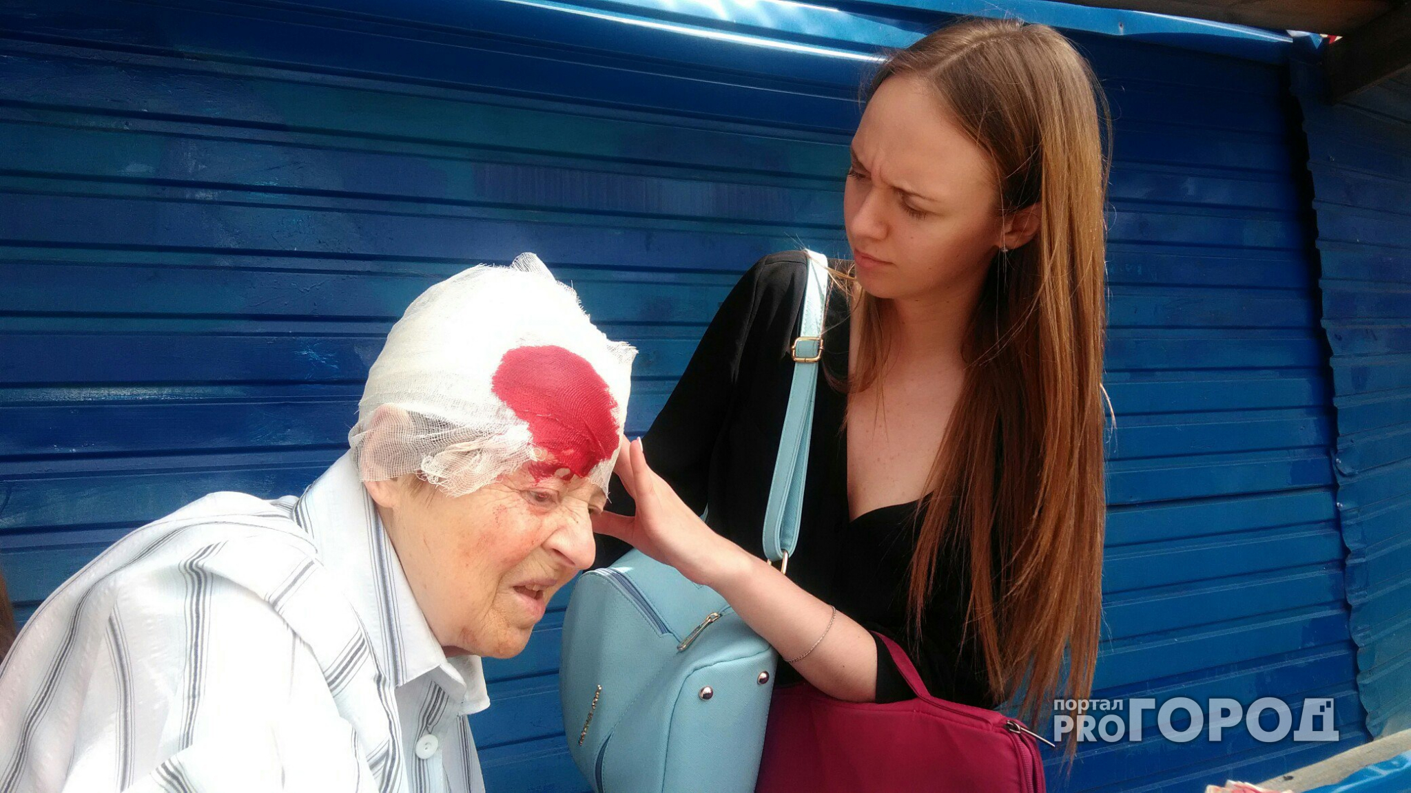 85-летняя бабушка разбила голову о синий забор по пути к депутату