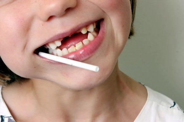 Стоматологи напоминают: в Новый год страдает не только фигура, но и зубы