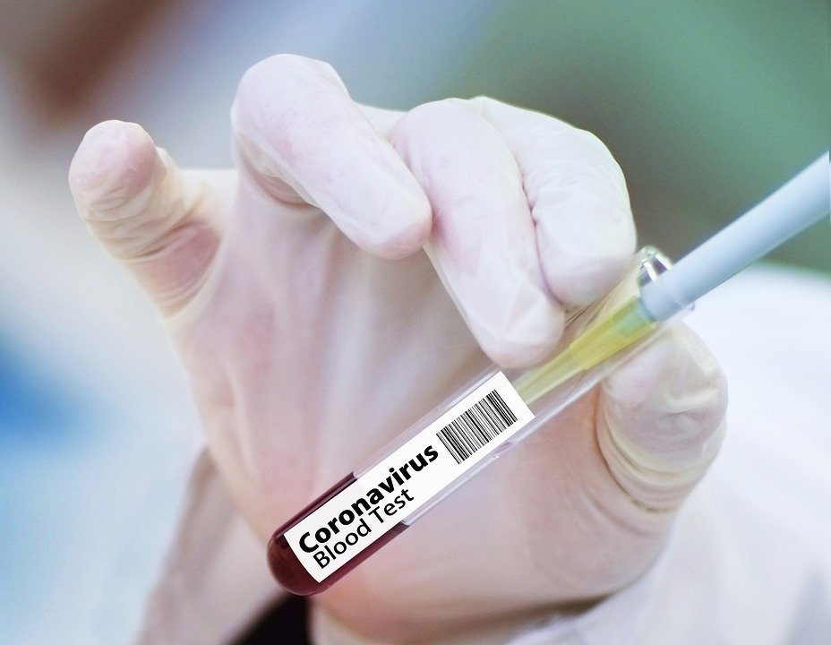 Российские ученые создали высокоточный тест для диагностики коронавирусной инфекции