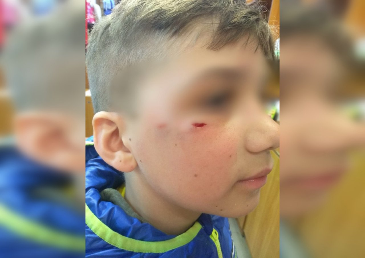 Появилось видео с моментом нападения собаки на мальчика на Бору